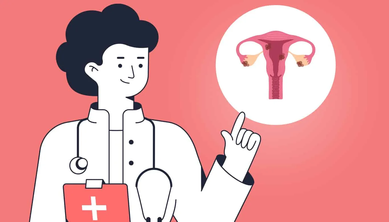 Os Estágios da Endometriose
