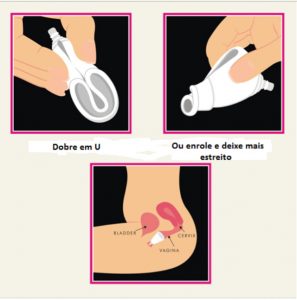 Coletor menstrual - benefícios e riscos