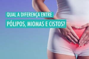Qual a diferença entre pólipos, miomas e cistos