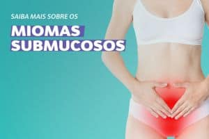 Miomas Submucosos - Sintomas, Diagnóstico e Tratamento
