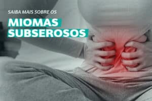 Miomas Subserosos. Você sabe o que são?