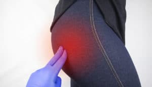 Endometriose no Nervo Ciático